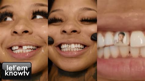 what happened to chrisean rock front tooth|Chrisean Rock Replaces Her Missing Tooth Then。